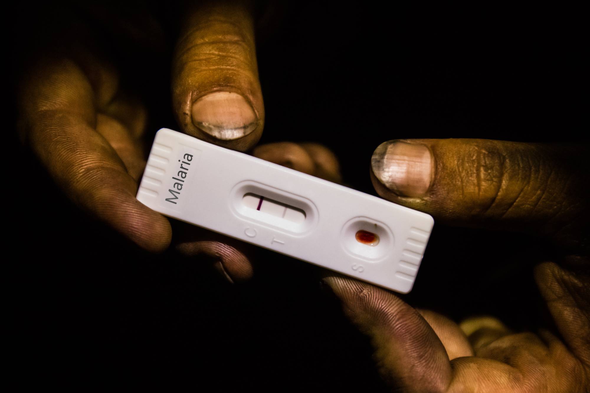 szczepienia dla podróżujących, malaria test